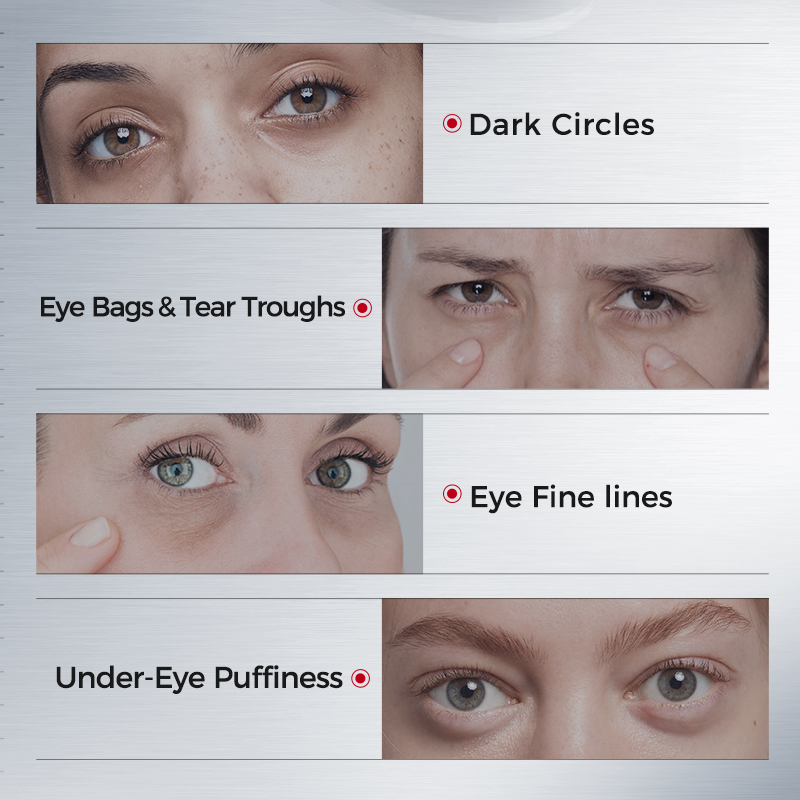 Płatki pod oczy na cienie pod  – Collagen Eye Patch recenzja i cena