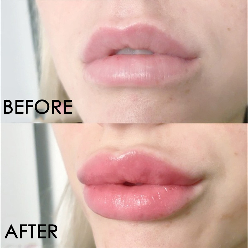 Serum do pielęgnacji ust Natyc – Lip Gloss Plumping recenzja i cena